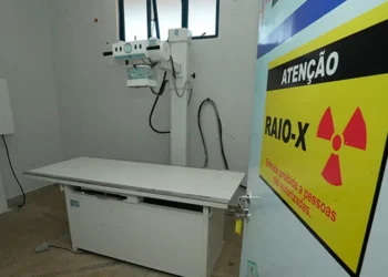 TCE aponta raio-X parado há sete anos e falta de médicos em hospital de Monte do Carmo
