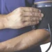 Defensoria Pública ajuíza ACP a fim de regularizar, em Palmas, serviço de exames cardiológicos essenciais